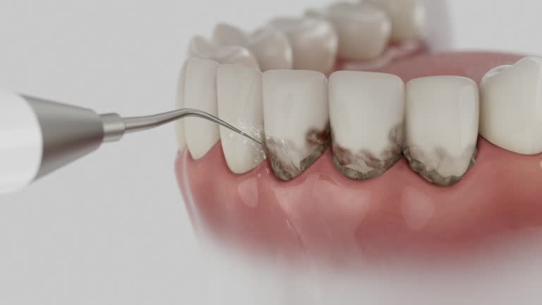 Reliable Dental contractor in East Richmond Heights, CA by Dentist Open Now